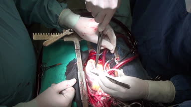 Cerrahın kliniğinde kişinin canlı organ işlemi sırasında kalbini diker.