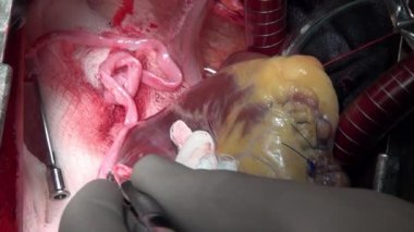 Kalp uçak cerrah profesyonel doktor benzersiz makro tarafından klinikte kesim video.