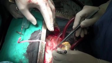 Kalp uçak cerrah profesyonel doktor benzersiz makro tarafından klinikte kesim video.