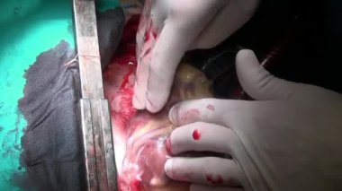 Kalp klinik bizzat canlı organ üzerinde çalışması sırasında.