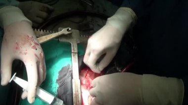 Kalp klinik bizzat canlı organ üzerinde çalışması sırasında.