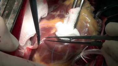 Kalp Cerrahisi Kliniği.