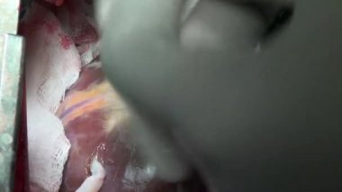 Cerrahlar el Kalp Cerrahisi kliniğinde yapacaklar..