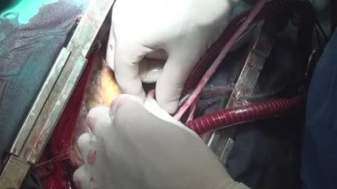 Cerrahlar el Kalp Cerrahisi kliniğinde yapacaklar..