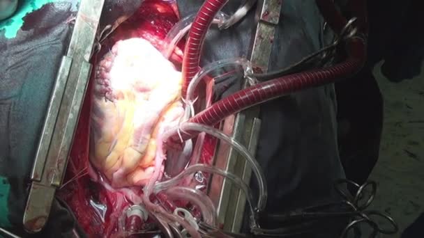 Cirujano del corazón médico profesional único macro video en la clínica . — Vídeos de Stock