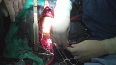 Kalp klinik bizzat canlı organ üzerinde çalışması sırasında.