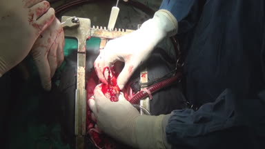 Kalp klinik bizzat canlı organ üzerinde çalışması sırasında.