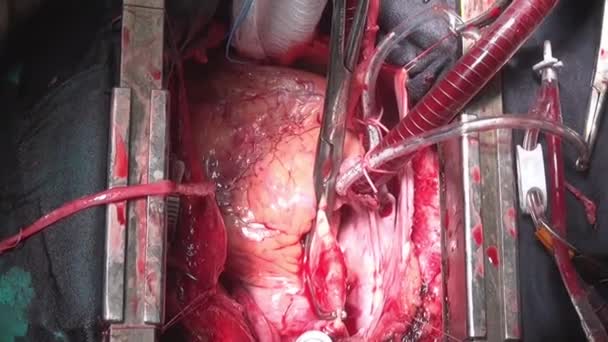 Batimentos cardíacos durante a cirurgia em órgão vivo único macro vídeo close-up na clínica . — Vídeo de Stock