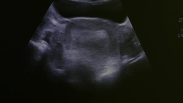 Imagen del útero de la mujer en el equipo de examen de ultrasonido monitor . — Vídeos de Stock