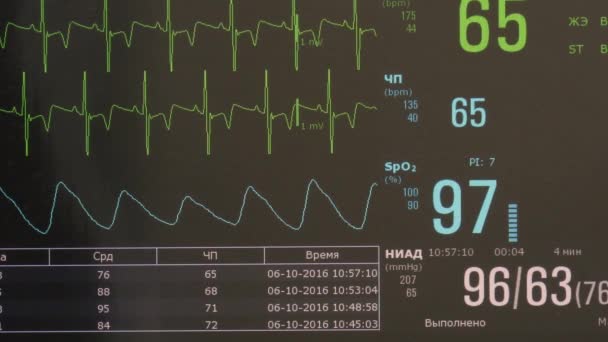 Cardiografía del ritmo cardíaco e imagen del pulso en el monitor durante la operación . — Vídeo de stock