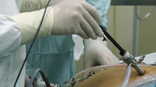Bauchspiegelung im Operationssaal in Nahaufnahme. — Stockvideo