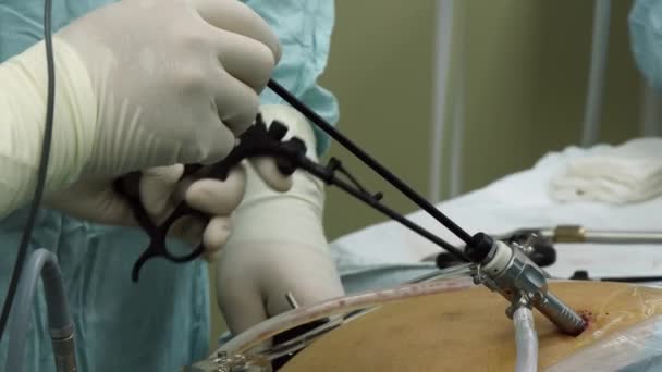 Laparoscopia abdominal en primer plano en quirófano . — Vídeo de stock