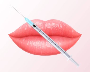 İğne şırıngalı pembe dudakların vektör çizimi. Güzellik, makyaj ve dudak büyütme için mükemmel. Kadın öpücüğü, bir gülümseme. Parlak ve göz alıcı bir görünüş. Canlı renkte 3 boyutlu gerçekçi dudaklar.