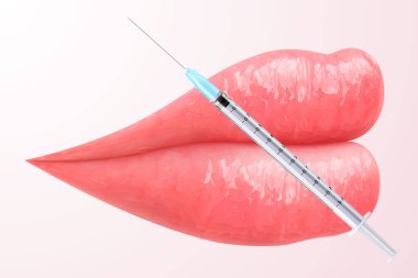 İğne şırıngalı pembe dudakların vektör çizimi. Güzellik, makyaj ve dudak büyütme için mükemmel. Kadın öpücüğü, bir gülümseme. Parlak ve göz alıcı bir görünüş. Canlı renkte 3 boyutlu gerçekçi dudaklar.