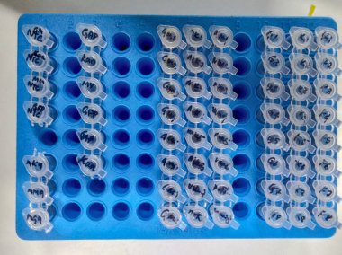 Laboratuvardaki bir masada bulunan bir kutuya yerleştirilmiş biyolojik numunelerden oluşan işaretli laboratuvar tüpleri..