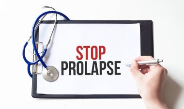 Doktor elinde yazılı bir kart tutuyor. SOP PROLAPSE, tıbbi konsept.