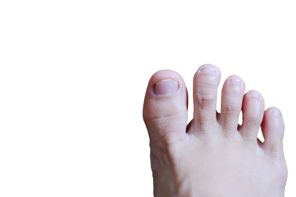 Closed Female Feet French Nails Wood Floor Healthy Care Medical — Stock Photo, Image