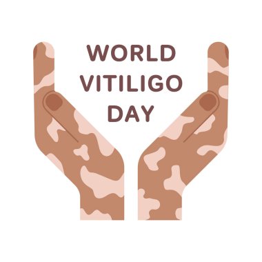 Dünya Vitiligo Günü. Kare poster ya da kart şablonu. İki simetrik insan eli ve metin. Kutlama afişinin renkli düz çizimi. Beyaz arkaplanda izole edilmiş vektör resmi