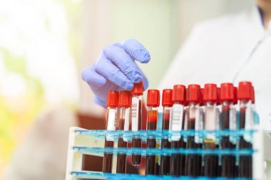 doktor el laboratuvar arka planda analiz makineleri ile bir raftan bir kan örneği tüp alarak / Teknisyen araştırma laboratuvarında kan tüpü testi tutan