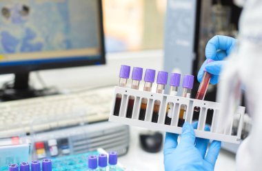 doktor el laboratuvar arka planda analiz makineleri ile bir raftan bir kan örneği tüp alarak / Teknisyen araştırma laboratuvarında kan tüpü testi tutan