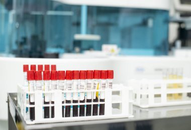 Test için kan örneği tüpler