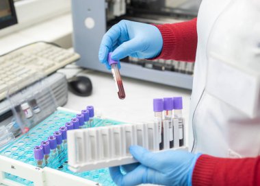 doktor el laboratuvar arka planda analiz makineleri ile bir raftan bir kan örneği tüp alarak / Teknisyen araştırma laboratuvarında kan tüpü testi tutan