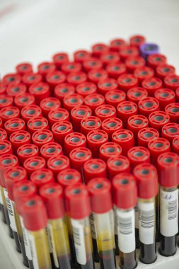 Test için kan örneği tüpler