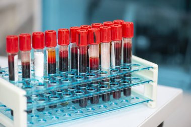 Test için kan örneği tüpler