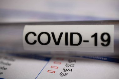 Corona virüsü covid-19 tanı, aşı ve araştırma konsepti: laboratuvar talep belgesinde izole edilmiş kan örneği şişesinin makro yakın çekimi