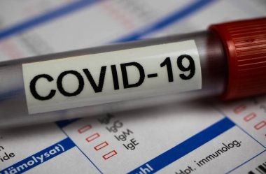 Corona virüsü covid-19 tanı, aşı ve araştırma konsepti: laboratuvar talep belgesinde izole edilmiş kan örneği şişesinin makro yakın çekimi