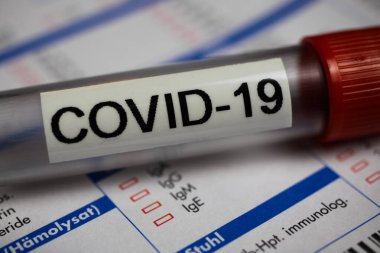 Corona virüsü covid-19 tanı, aşı ve araştırma konsepti: laboratuvar talep belgesinde izole edilmiş kan örneği şişesinin makro yakın çekimi