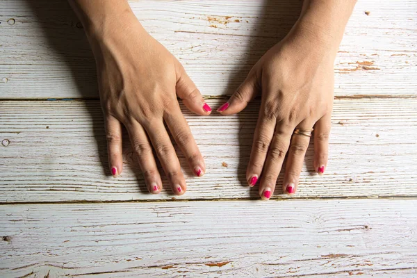 Verniz Unha Lascada Nas Unhas Dos Dedos Uma Mulher Mãos — Fotografia de Stock