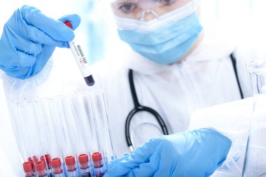 Korumalı bir iş elbisesi içindeki doktor tıbbi laboratuarda kan örneği tüpü test ediyor.