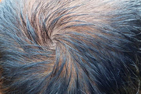 Asiático Hombre Cabello Calvo Cabeza Textura — Foto de Stock