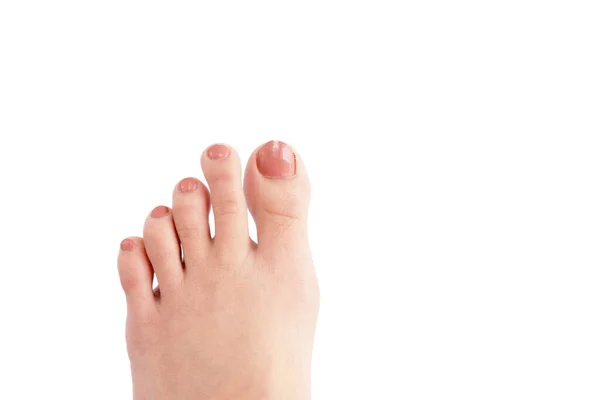 Foot Toes Asian Woman Which Has Index Finger Longer Thumb — Stock Photo, Image