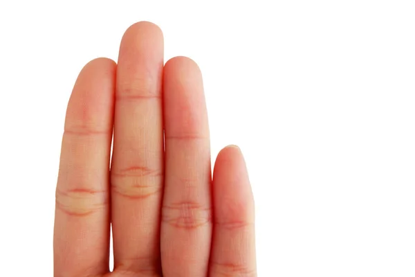 Close Finger Asian Woman Isolated White Background — Stock Photo, Image