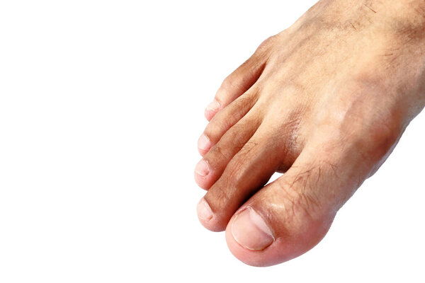 Dirty feet of Asian man isolated on white background