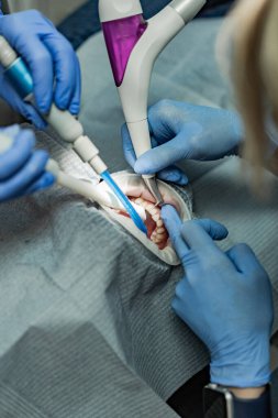 Optragate üzerinden ağzını aç. Diş hekimliği.