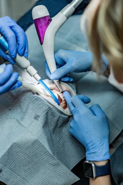 Optragate üzerinden ağzını aç. Diş hekimliği.