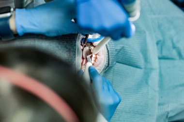 Optragate üzerinden ağzını aç. Diş hekimliği.