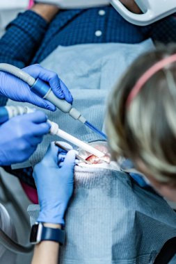 Optragate üzerinden ağzını aç. Diş hekimliği.