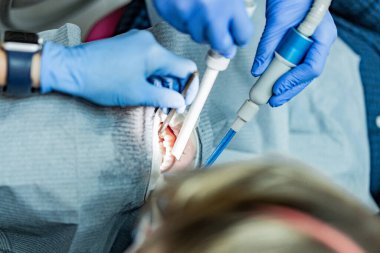 Optragate üzerinden ağzını aç. Diş hekimliği.