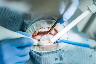 Optragate üzerinden ağzını aç. Diş hekimliği.