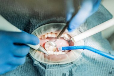 Optragate üzerinden ağzını aç. Diş hekimliği.