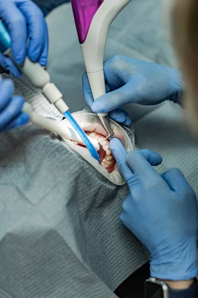 Optragate üzerinden ağzını aç. Diş hekimliği.