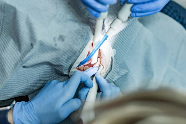 Optragate üzerinden ağzını aç. Diş hekimliği.