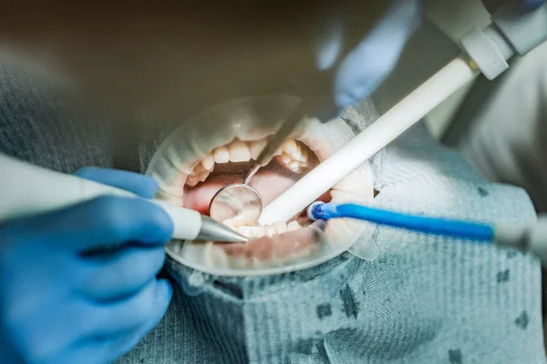 Optragate üzerinden ağzını aç. Diş hekimliği.