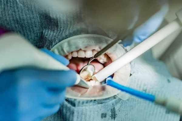 Optragate üzerinden ağzını aç. Diş hekimliği.