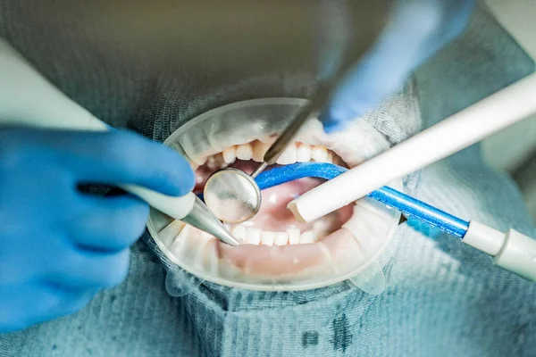 Optragate üzerinden ağzını aç. Diş hekimliği.