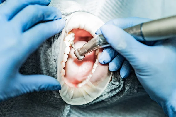 Optragate üzerinden ağzını aç. Diş hekimliği.